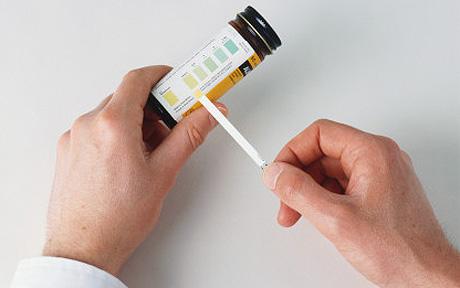 Urine Sample